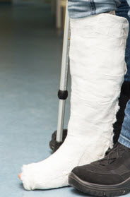 InjuredLeg InjuredLeg