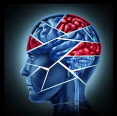 BrainInjury1 BrainInjury1