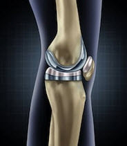Knee Knee
