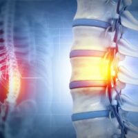 SpinalCord